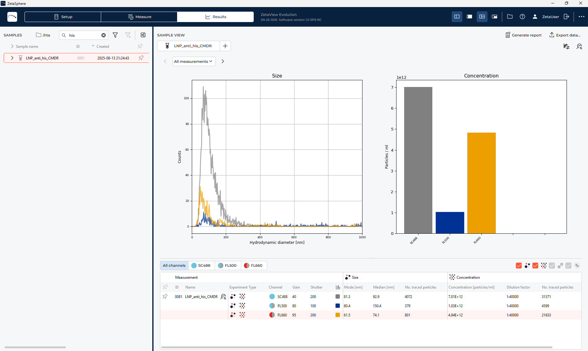 ZetaView® software interface showing single-particle analysis of His-tagged lipid nanoparticles using scatter and dual-channel fluorescence NTA.